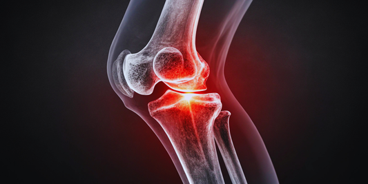 The Knee Bone’s Connected to the… Insole? Make It Groov.