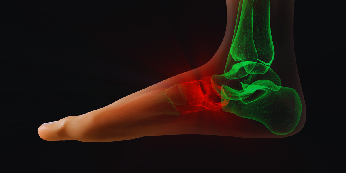 When Your Feet Ache, Everything Breaks — Groov Has the Fix